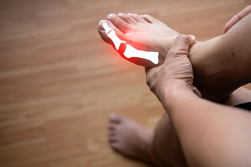 Fussschmerzen Hallux durch zu enge Schuhe